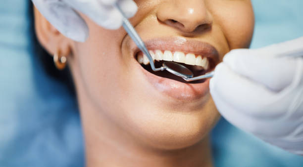 Best Emergency Gum Treatment in Fishers, IN